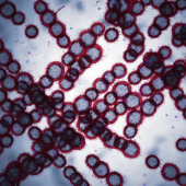 Microscopic image of bacteria